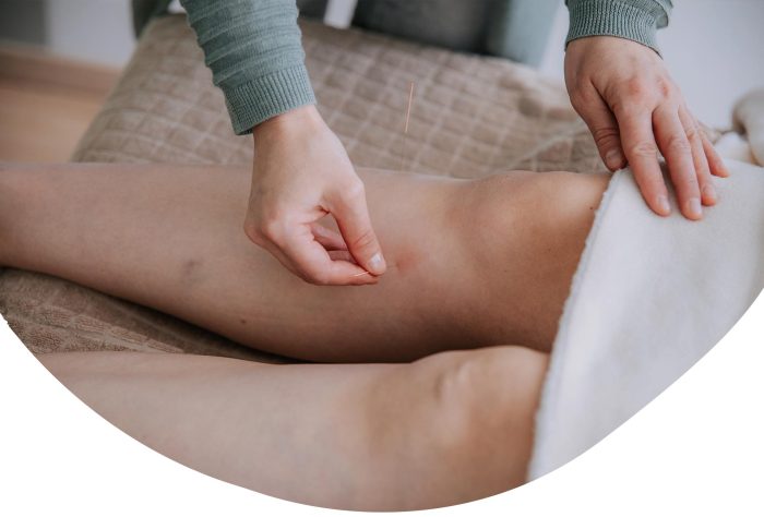 Acupunctuur4Vrouwen_blog_acupunctuur-en-endometriose Acupunctuur en endometriose