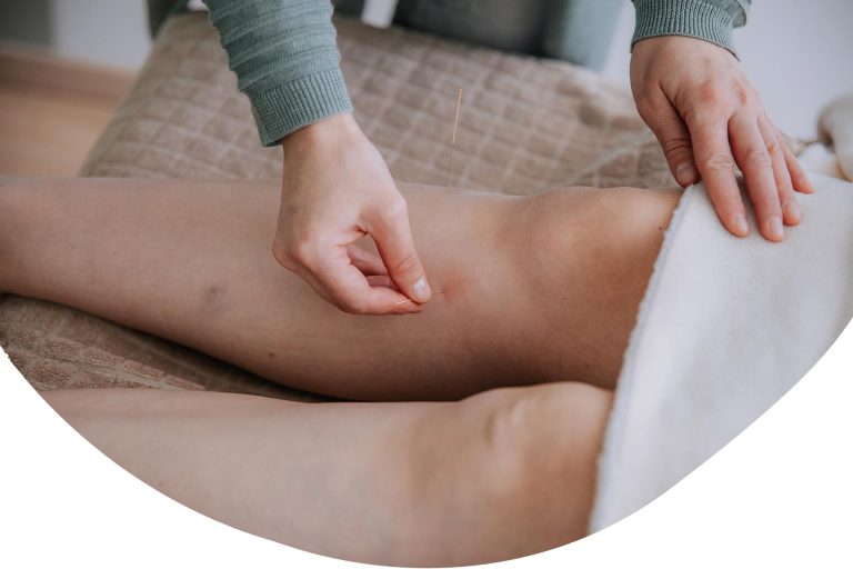 Acupunctuur en endometriose