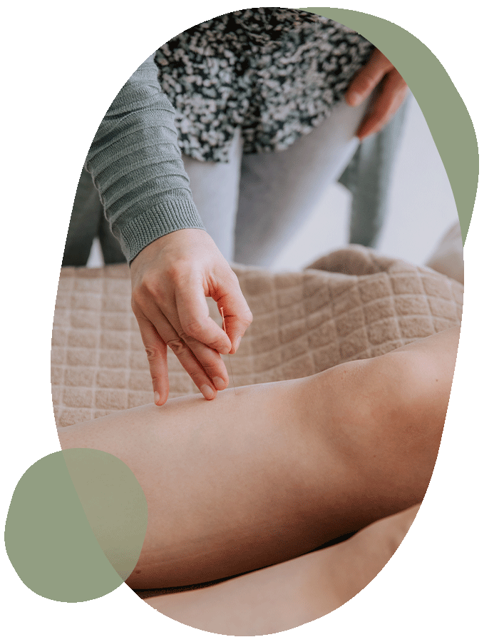 Acupunctuur in Zwolle