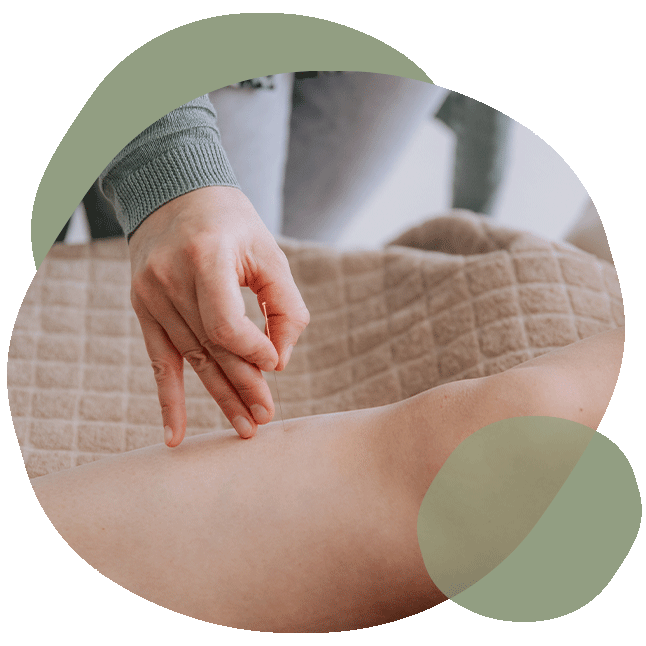 acupunctuur bij menstruatieklachten